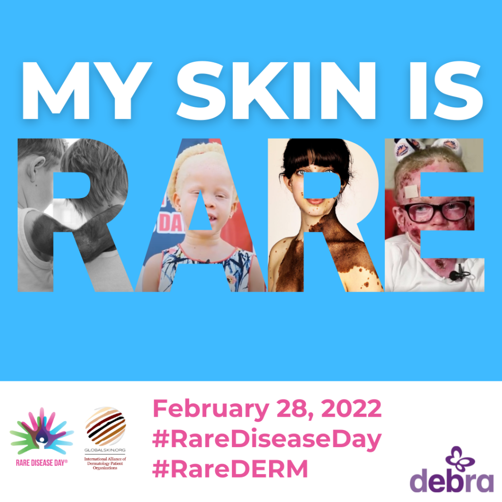 DAN RIJETKIH BOLESTI 28. veljače 2022. godine